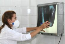 Governo cria comitê para reduzir casos de tuberculose até 2030